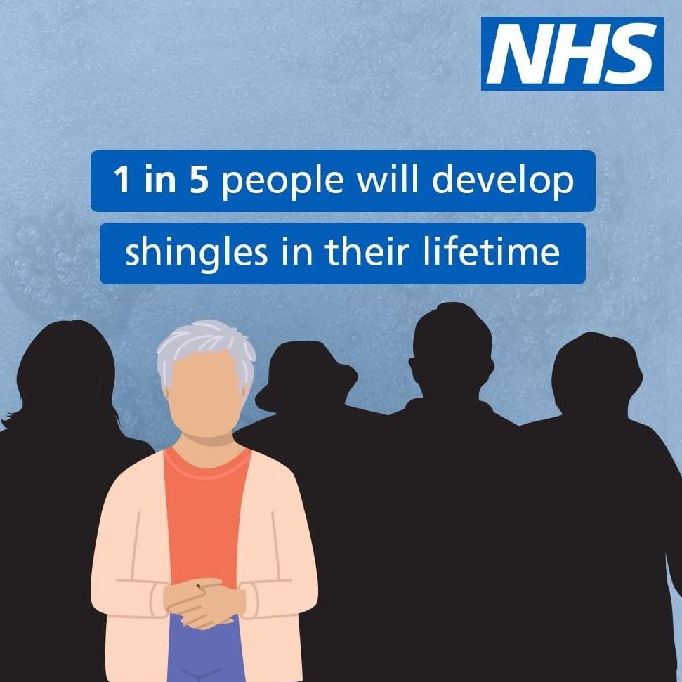 Shingles